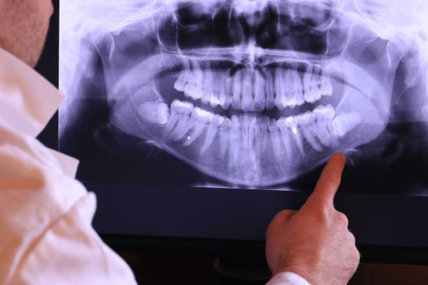 Best Emergency Treatment for Toothache in Pearl River, LA