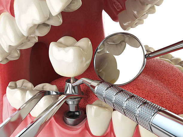 Best Emergency Orthodontic Repairs in Pearl River, LA